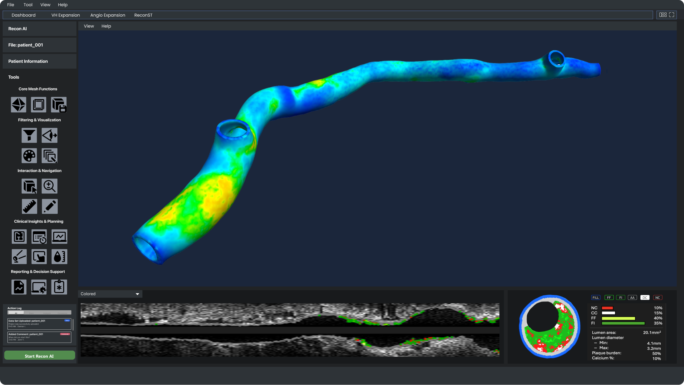 Sancorda Medical 3D platform interface